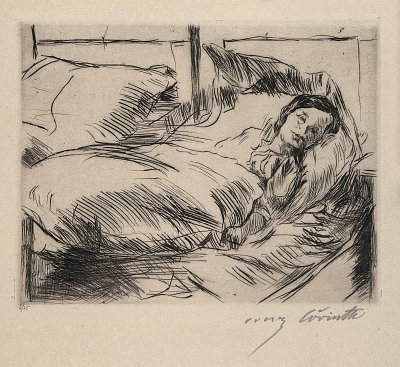 A female patient in a hospital bed Drypoint von Lovis Corinth als Kunstdruck auf Leinwand